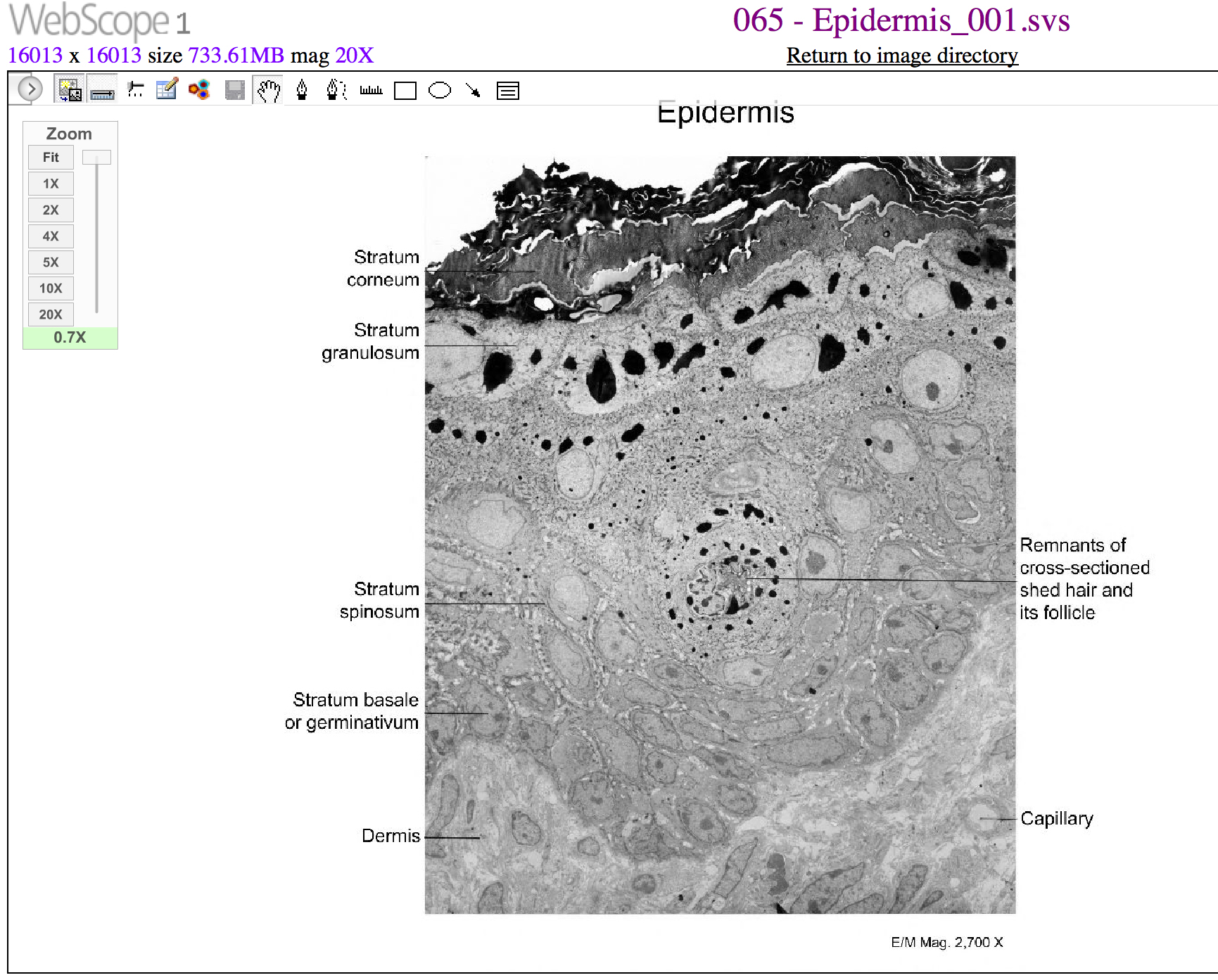 This micrograph of the epidermis shows stratum corneum as a rough, darkened layer. The next layer, the stratum granulosum, contains white cells with areas of black in their cytoplasm, equal in thickness to the stratum corneum. The third layer, the stratum spinosum, contains large, grayish cells. The stratum spinosum is the thickest layer, occupying half of the micrograph. A hair follicle is embedded in this layer, which is a round structure with black, concentric spots. The fourth layer is the stratum basalis, which contains grayish cells with clear, dark nuclei, similar in thickness to the stratum corneum. The dermis is the deepest layer, and is lightly-colored with interspersed gray cells. A cross-section of a capillary is visible within the dermis.