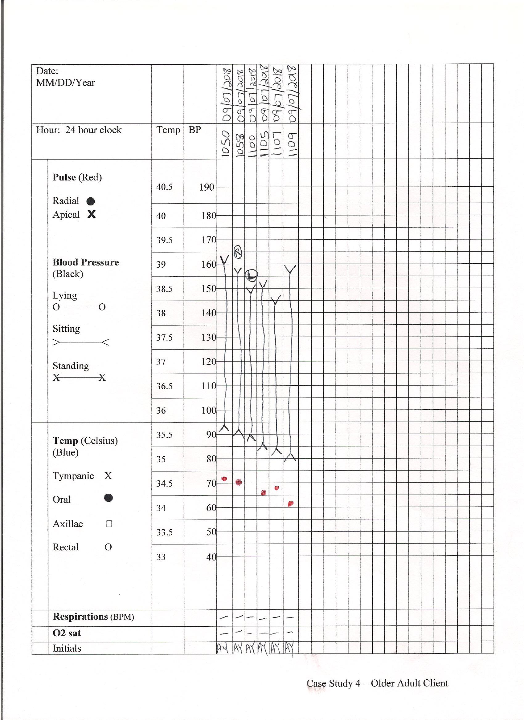 Vital sign record - case study 4