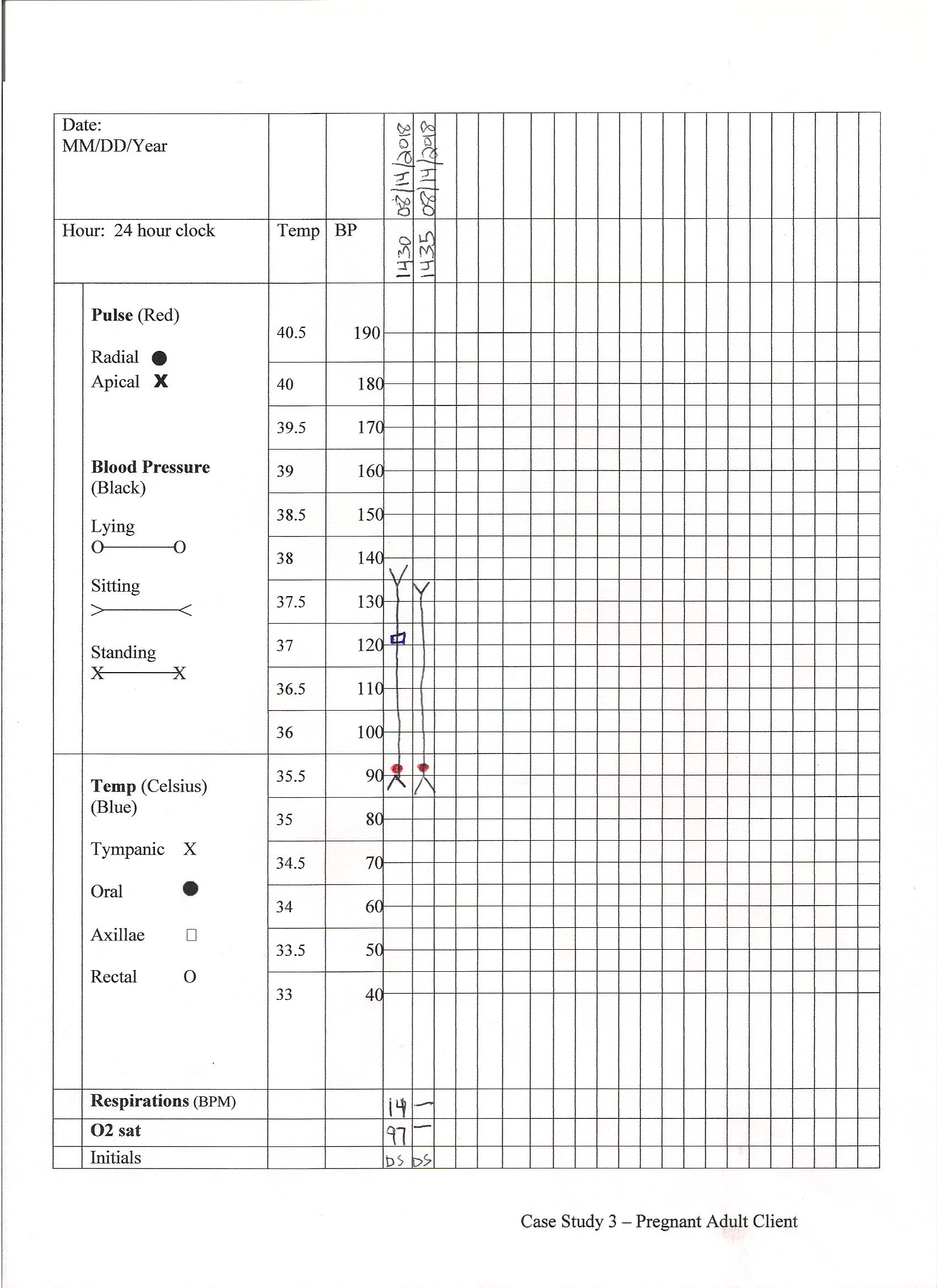 Vital sign record - case study 3